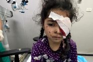 سازمان ملل متحد: حملات اسرائیل در غزه پاکسازی نژادی است